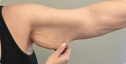 My Derma Dream